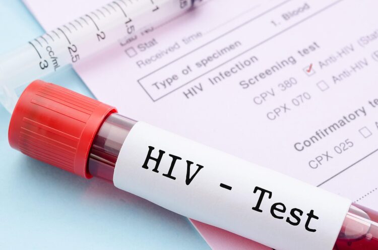 Africa unveils HIV prevention shot with 99.9% protection