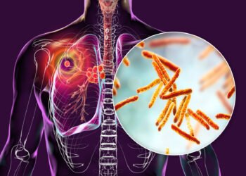 FCT Records 16,000 TB Cases as Treatment Success Hits 94%