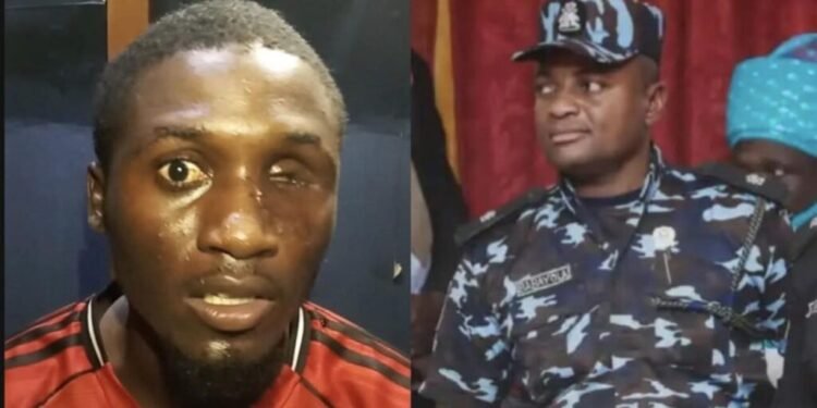 Barber sues Police, DPO for N1bn after allegedly losing eye to tear gas canister