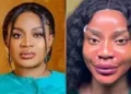 Nollywood actress Uche Ogbodo shares latest facial transformation