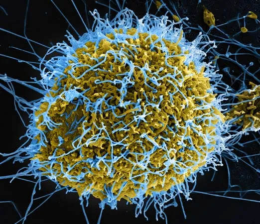CEPI funds $4.17m studies to test Ebola vaccines against Bundibugyo virus