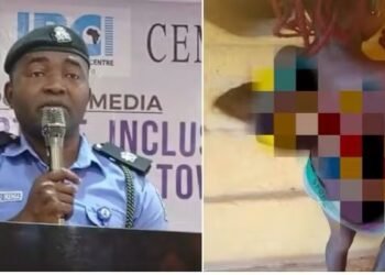 Mother arrested in Anambra for using hot knife on 7-year-old daughter