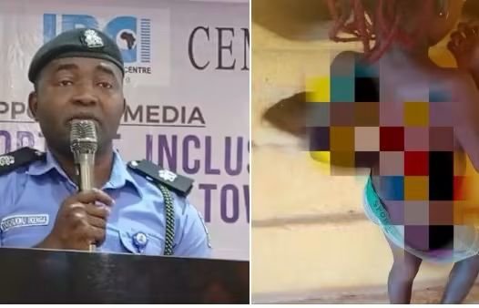 Mother arrested in Anambra for using hot knife on 7-year-old daughter