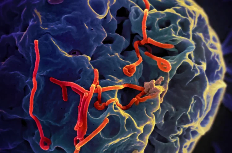 WHO advises against travel curbs as Nigeria confirms Ebola case