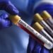 Ebola scare in Nigeria: 10 ways to stay safe