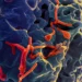 WHO advises against travel curbs as Nigeria confirms Ebola case