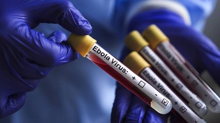 Ebola scare in Nigeria: 10 ways to stay safe